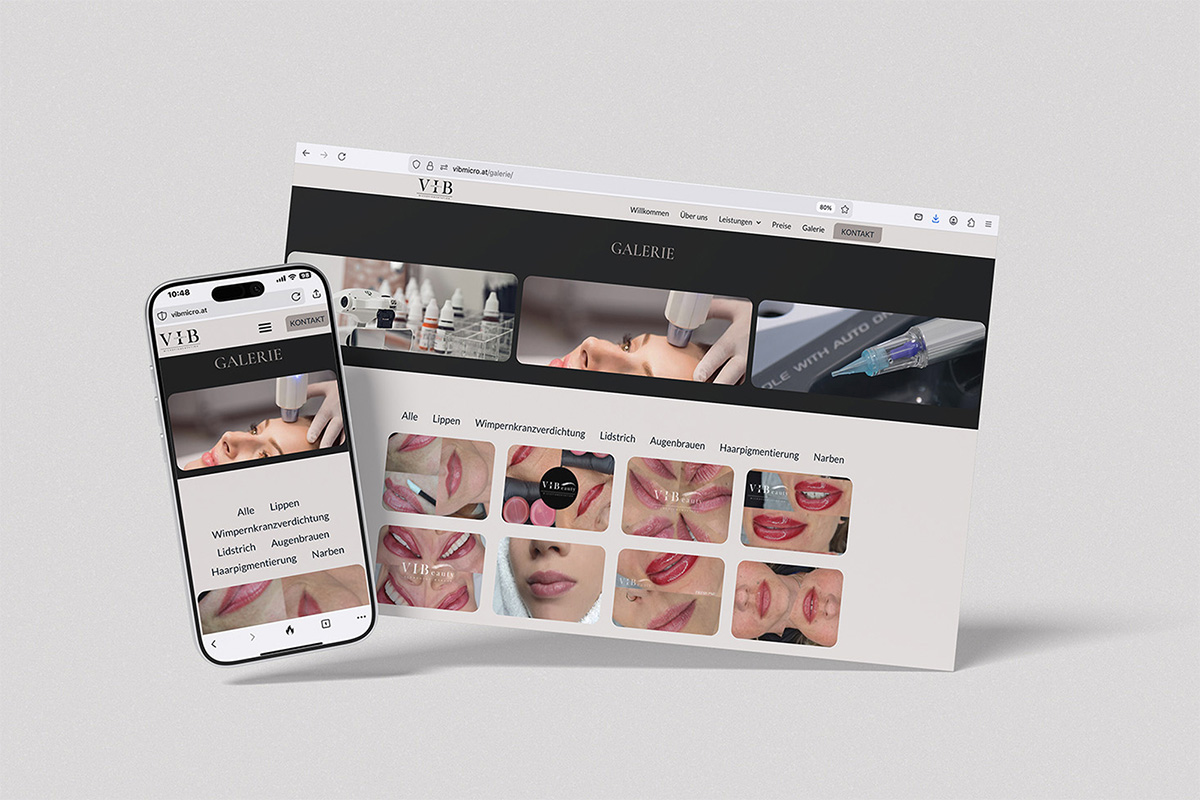 VIBmicro Galerie